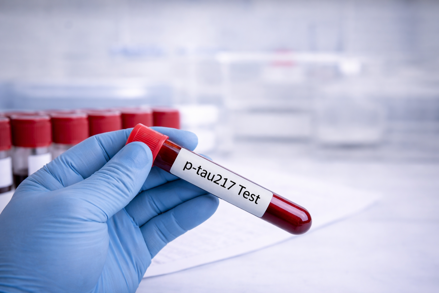pTau217 - Biomarkers for Early Alzheimer Detection